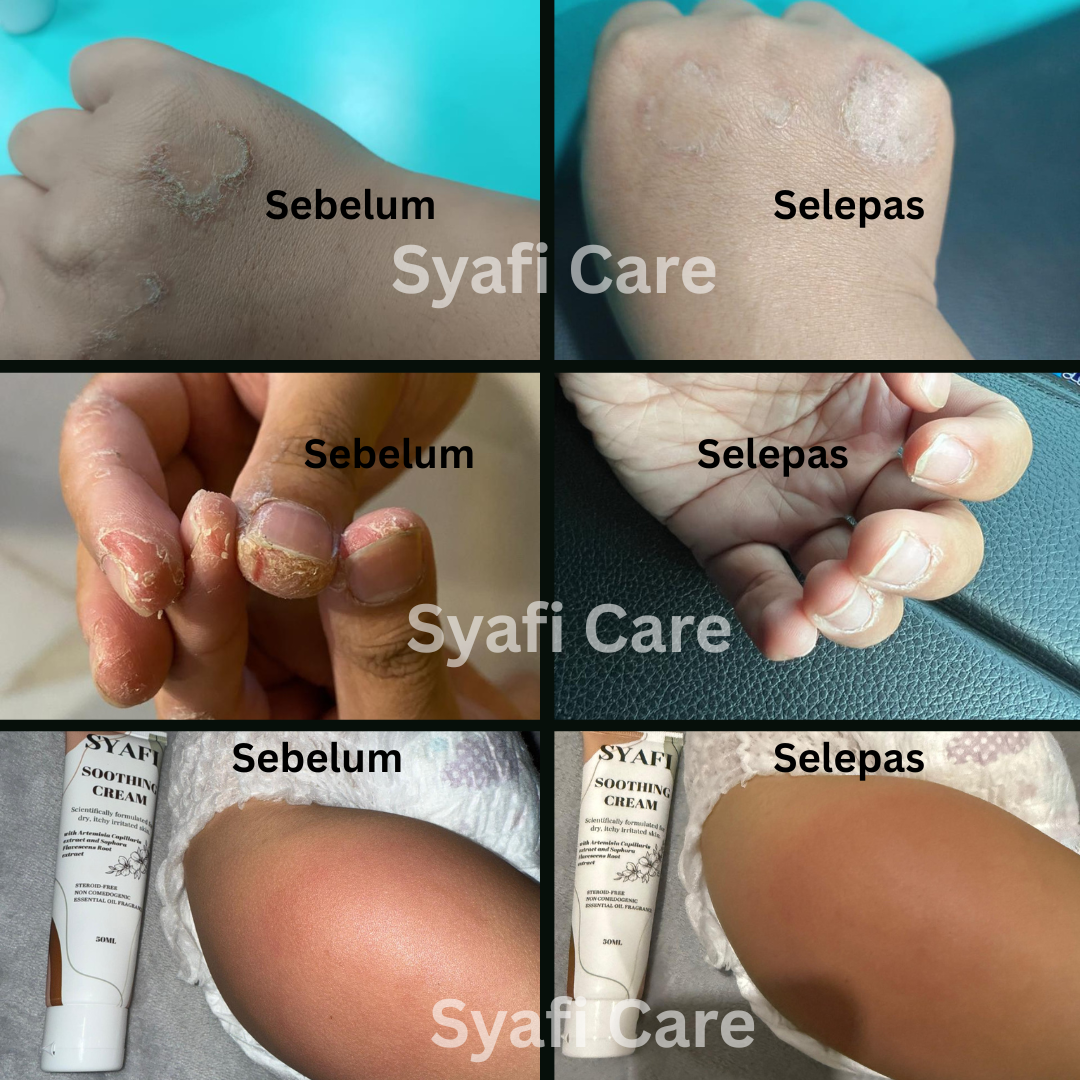 Produk Syafi Care